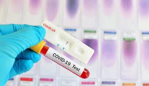 France : baisse du nombre de nouveaux cas de COVID-19