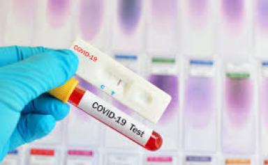 France : baisse du nombre de nouveaux cas de COVID-19